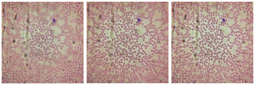 Punased verelibled koolimikroskoobis