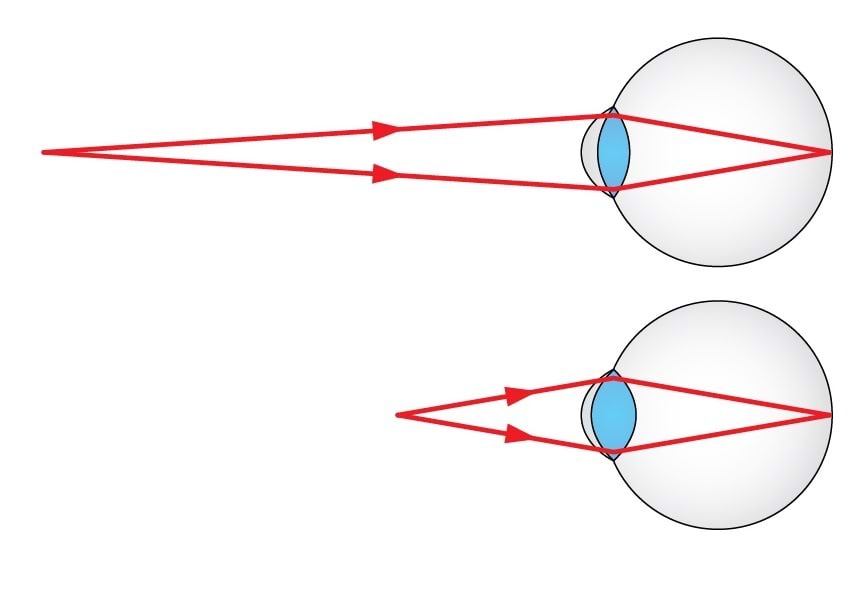 Normaalnägija silm kaugele ja lähedale vaadates